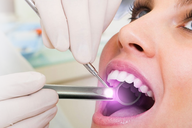Oral Cancer Screening at Westheights Dental